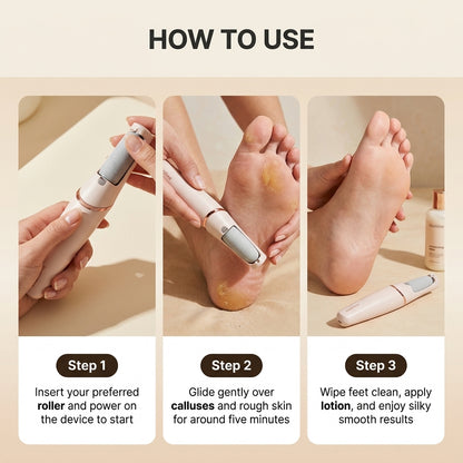 Southline Callus Remover