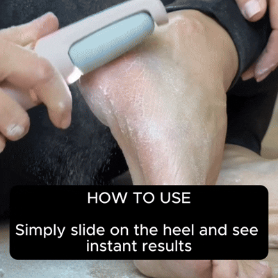 Southline Callus Remover